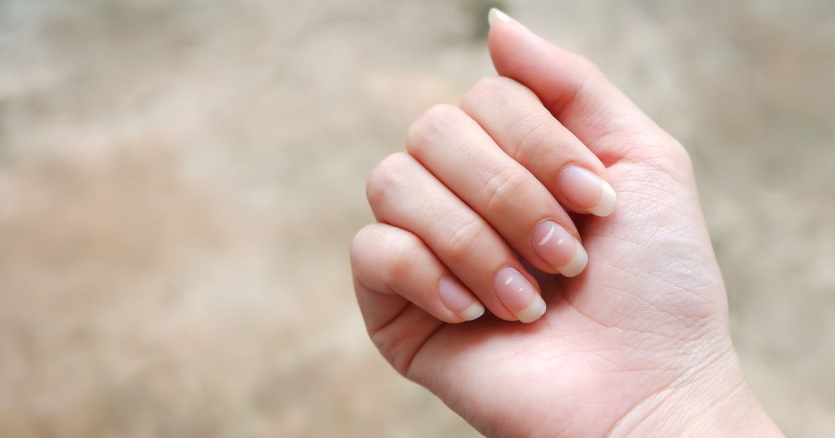 here-s-white-flecks-on-your-nails-actually-mean-huffpost-uk-life