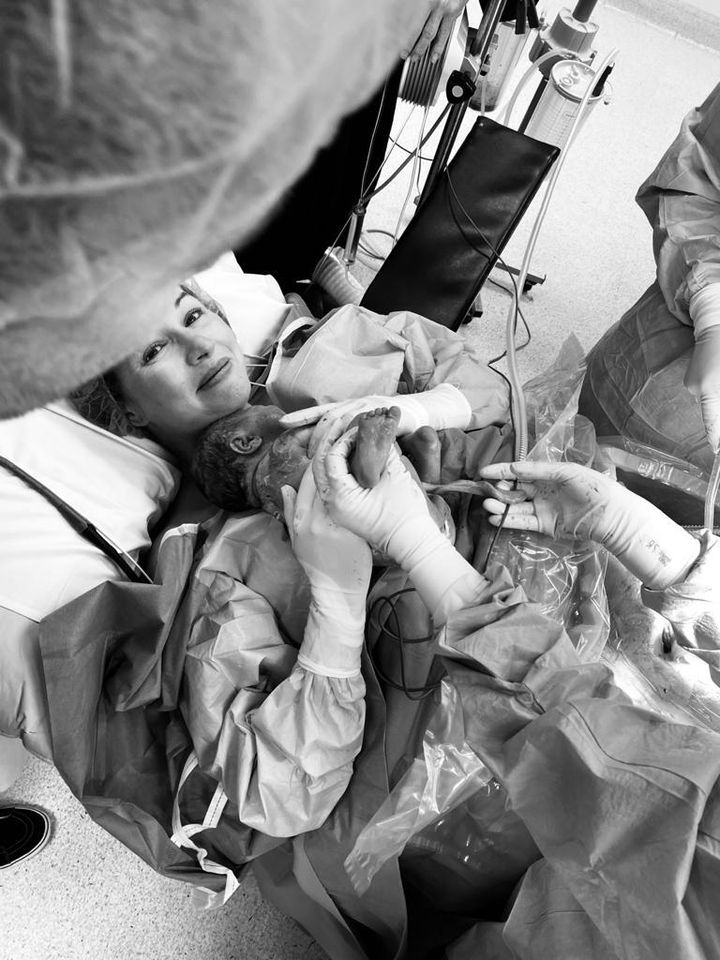 Lyz Evans, an Australian physiotherapist, holds her baby immediately following birth, while the medical team completes the surgery.