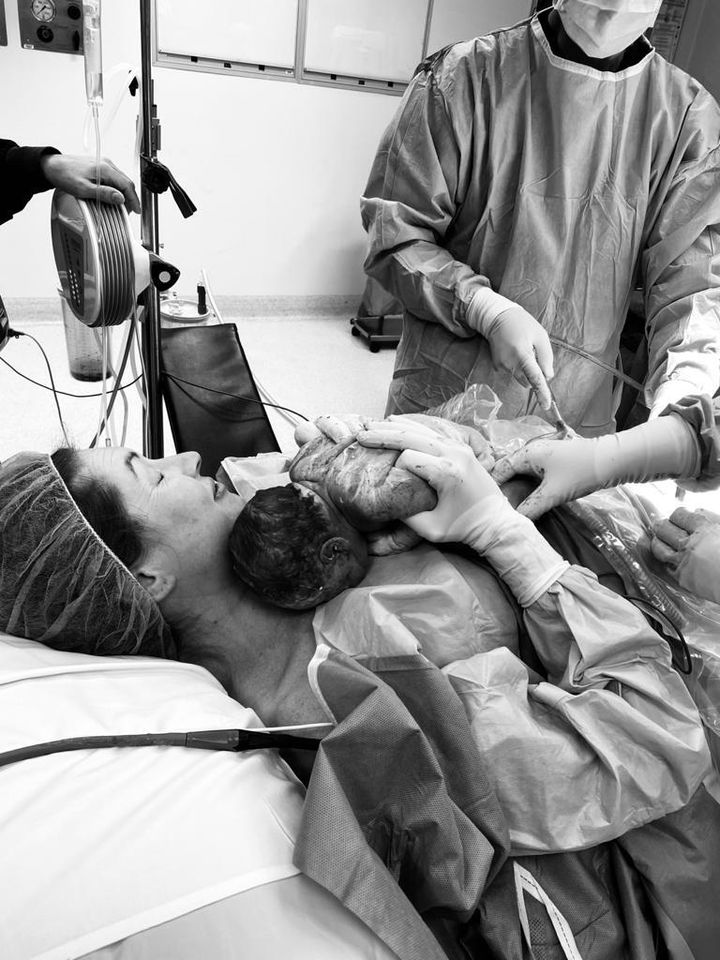 Evans brings her child to her chest during her c-section.