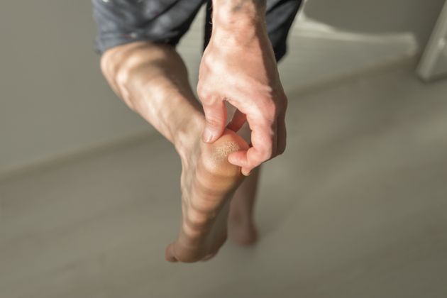 Close-Up Of Human Feet