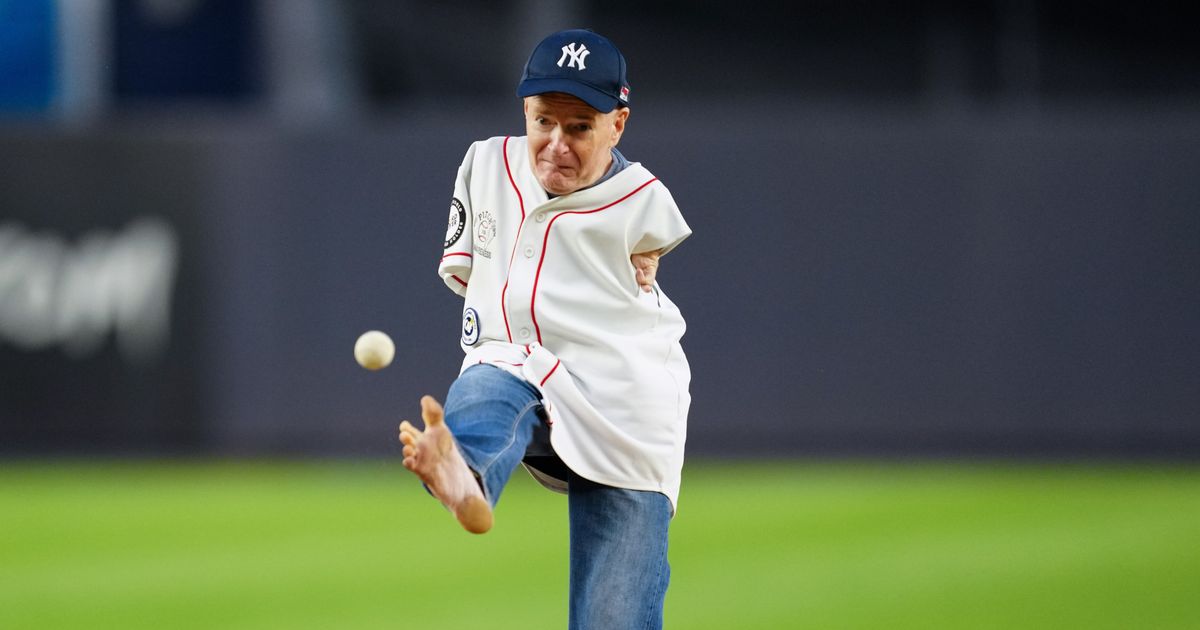 Armless Man's Major Feat Is Throwing First Pitch At Yankee Stadium