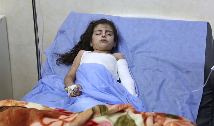 An Iraqi girl with burns on her arm rests on a bed in a hospital on Wednesday.