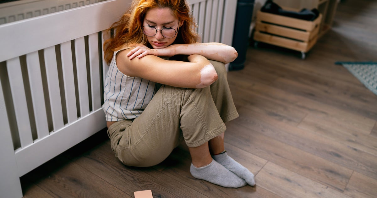 3 Actions To Take Now If You're Too Worried To Go To Work - Vimarsana News