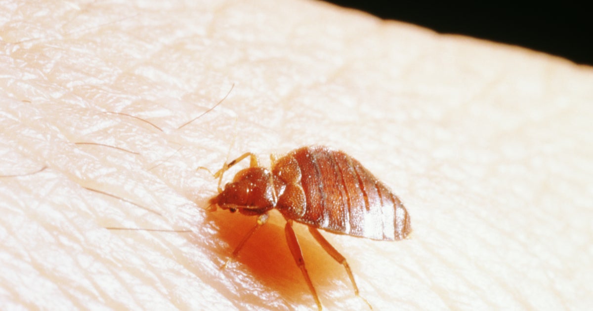 Eliminate Bed Bugs With A Common Pantry Item - Vimarsana News