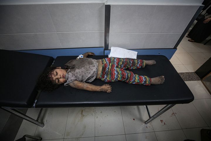 GAZA CITY, GAZA - OCTOBER 11: An injured child lies on the stretcher after they were brought to Al-Shifa Hospital, in Gaza City, Gaza as Israel's attacks on the Gaza Strip continue on its fifth day on October 11, 2023. (Photo by Mustafa Hassona/Anadolu via Getty Images)
