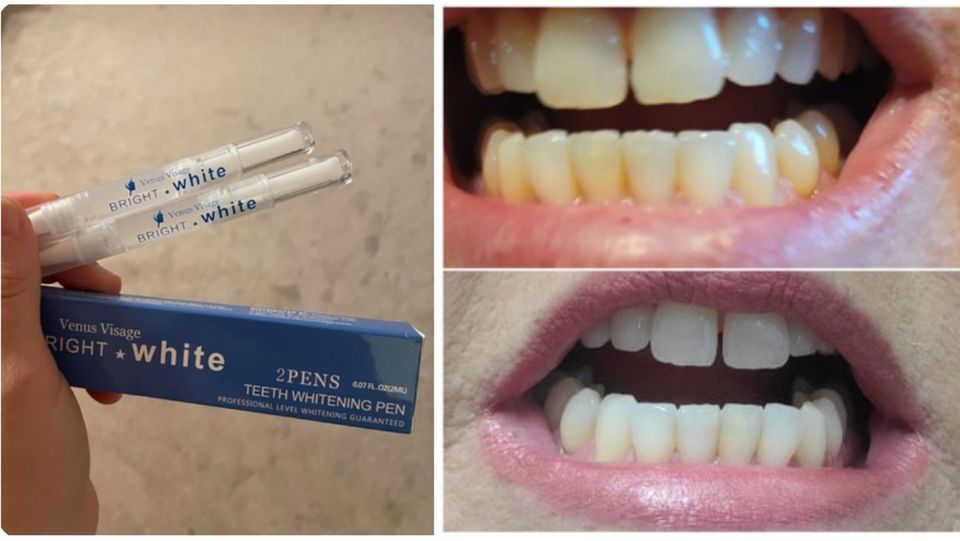 A pack of two pain-free teeth whitening pens