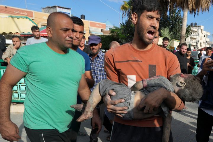 Παλαιστίνιο παιδί που τραυματίστηκε από ισραηλινό βομβαρδισμό μεταφέρεται σε νοσοκομείο στο Ντέιρ ελ Μπάλα, στη Λωρίδα της Γάζας, Τρίτη 17 Οκτωβρίου 2023.
