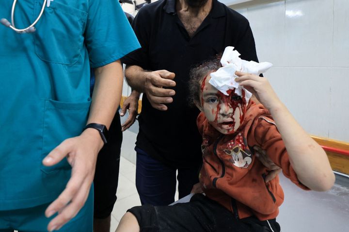 An injured girl holds a handkerchief to her head at the Al-Nasr hospital, following Israeli bombardment in Khan Yunis in the southern Gaza Strip on Oct. 26 amid the ongoing battles between Israel and Hamas.