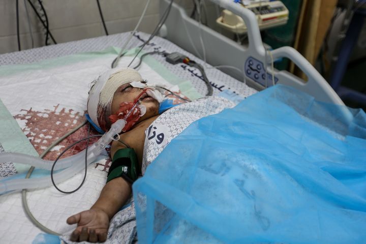 Παιδί σοβαρά τραυμαισμένο και διασωληνομένο στο νοσοκομείο Νάσσερ. ΟΙ γιατροί ελπίζουν να "περάσει' στην Αίγυπτο ώστε να έχει μια ελπίδα να ζήσει. 
