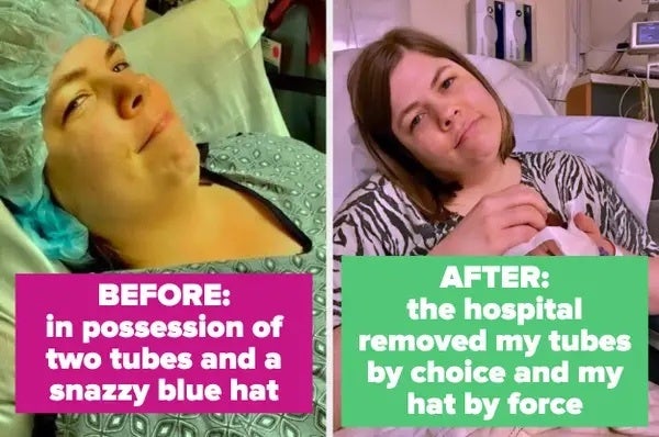 Gorgeous gorgeous girls tilt their heads 45 degrees after surgery.