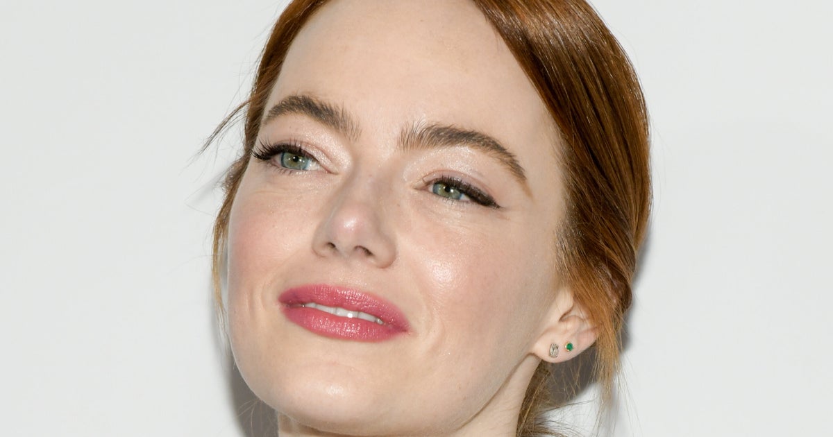 NextImg:Emma Stone Explains How She Ended Up With A Black Eye The Week Of Her Wedding