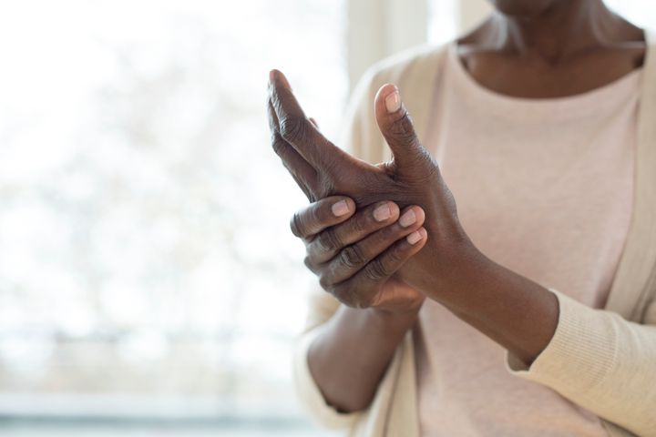 Experts share the hallmark signs of arthritis. 