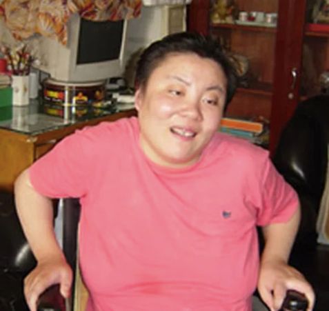 Η Ζου Λινγκ παράλυτη και σχεδόν τυφλή με σοβαρή εγκεφαλική βλάβη, χρόνια μετά την δηλητηρίαση 