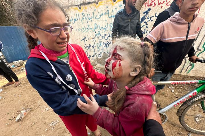 Τραυματισμένο κοριτσάκι σε επίθεση του Ισραήλ στην περιοχή αλ Ζαουίντα της Λωρίδας της Γάζας 