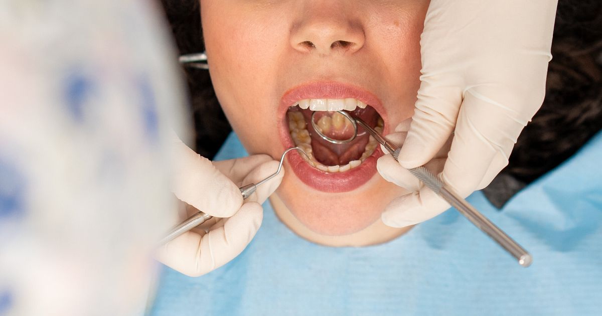 Woman Sues Dentist Who Performed Too Much Dental Surgery In 1 Visit