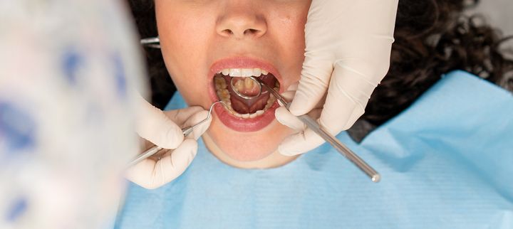 A Minnesota woman has sued her dentist after receiving four root canals, eight dental crowns and 20 fillings in a single visit that she says led to her disfigurement.