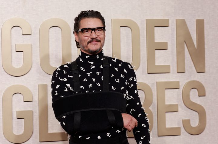 Pedro Pascal kept things hush-hush about how he suffered an arm injury.