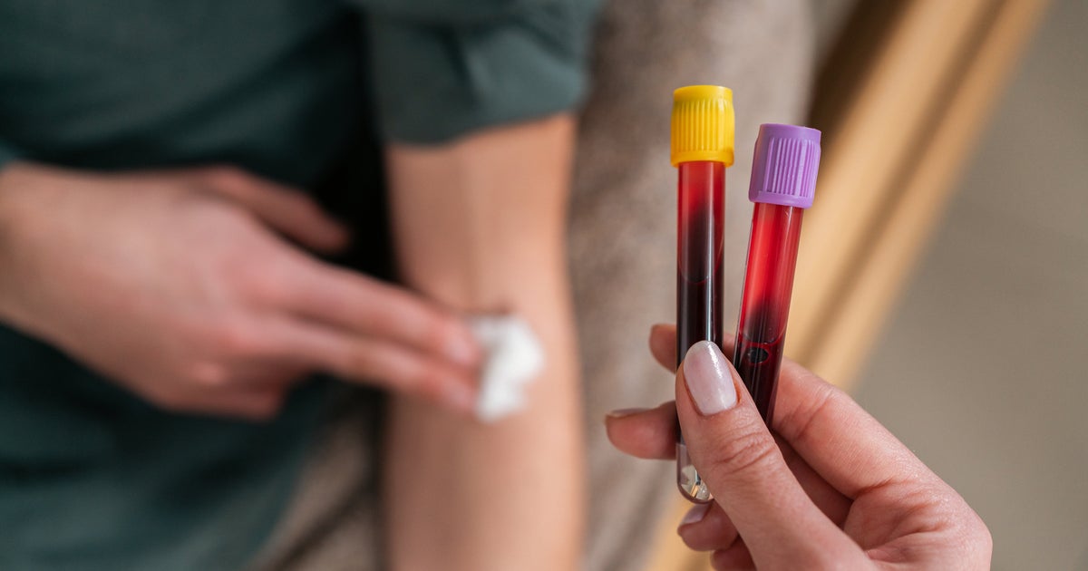 NextImg:Red Cross Announces Emergency Blood Shortage, Fewest Donors In 20 Years