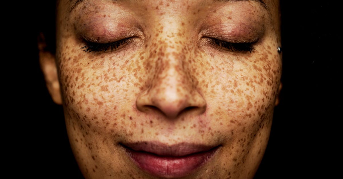 Health Conditions Your Dermatologist Can Detect Just From Looking At Your Skin