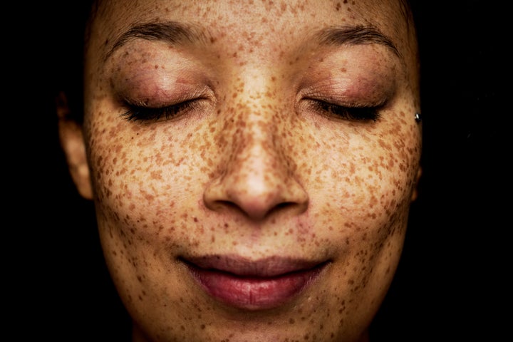Sick Complexion Health Issues That Your Doctor Can Spot By Looking At Your Skin ...