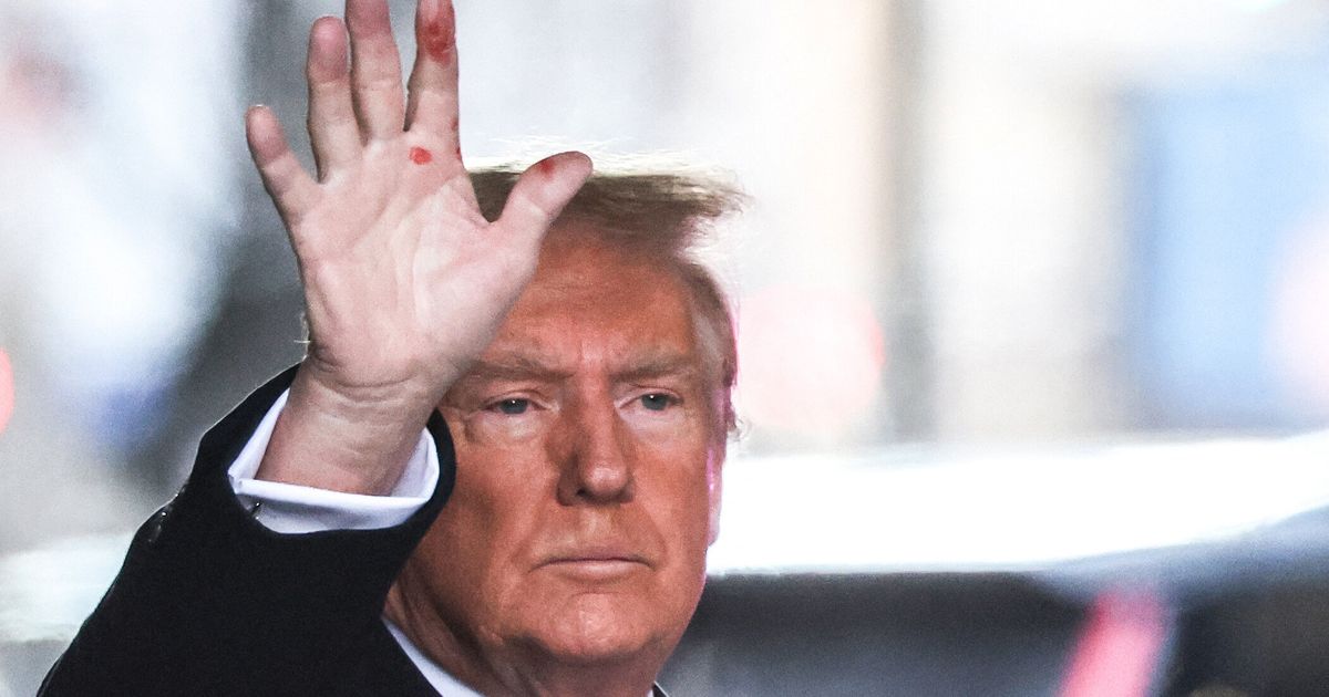 Donald Trump Finally Speaks Out About Those Red Splotches On His Hand