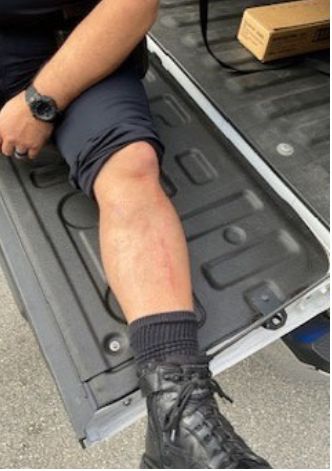The Sunny Isles Beach Police Department included a photo of the officer's leg in its report on the incident with Avraham Gil.