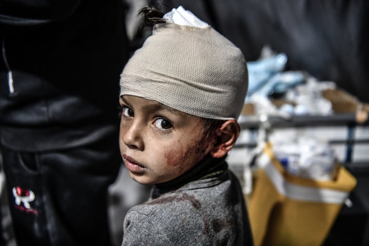 Injured Palestinians, including children are brought to Kuwait Hospital for treatment following Israeli attacks on Rafah City in the south of Gaza on February 12, 2024. (Photo by Abed Zagout/Anadolu via Getty Images)