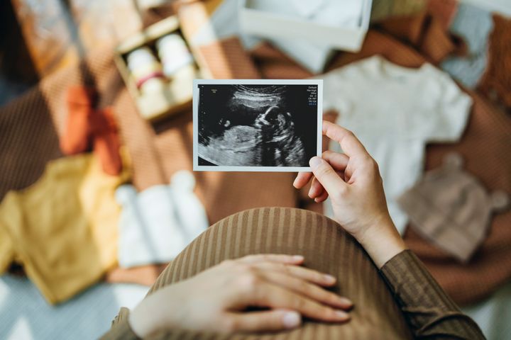 Personal perspective of Asian pregnant woman looking at an ultrasound scan photo while gently touching her baby bump, with baby clothings and accessories laying on the floor. Mother-to-be. Preparation for a new family member. Expecting a new life concept