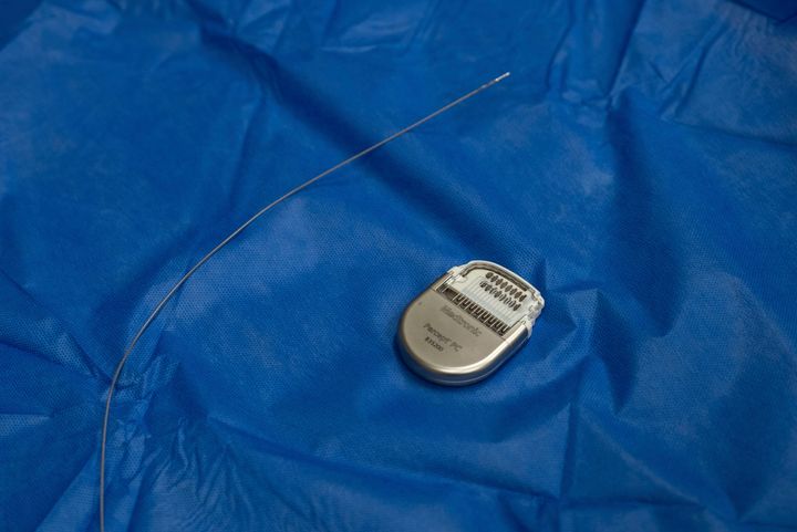 Ένα δείγμα συσκευής που μοιάζει με βηματοδότη και χρησιμοποιείται για τη θεραπεία βαθιάς εγκεφαλικής διέγερσης, καθώς και τα ηλεκτρόδια που εμφυτεύονται σε συγκεκριμένο σημείο του εγκεφάλου, εκτίθενται στο Mount Sinai West στη Νέα Υόρκη στις 20 Δεκεμβρίου 2023.