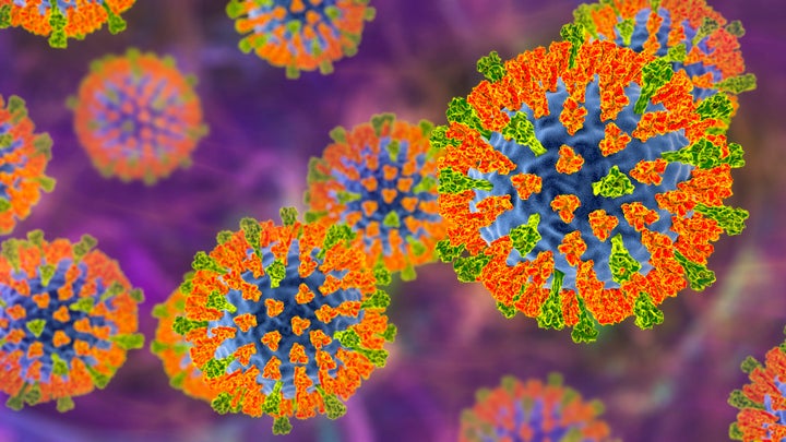 Florida Has A Measles Outbreak. Here's What That Actually Means For You. 2 Small measles outbreaks are becoming more and more frequent as childhood vaccination rates decline.