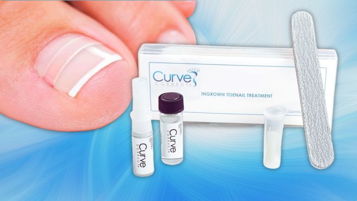 The CurveCorrect ingrown toenail home treatment kit.