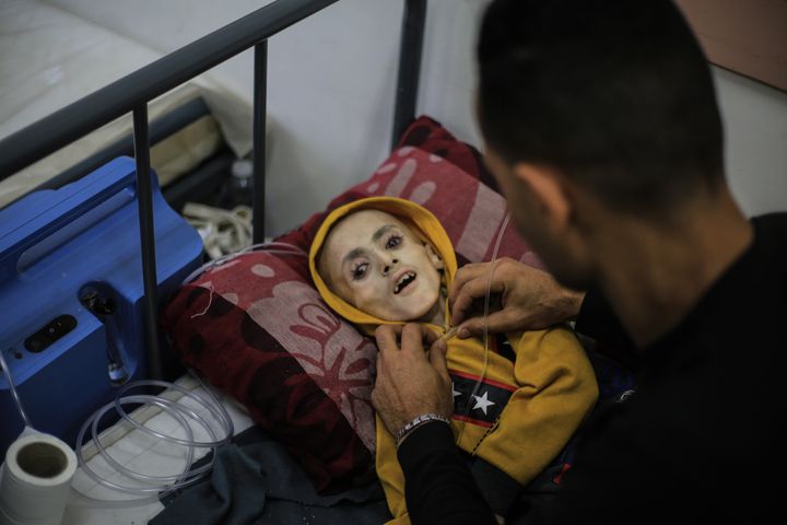 Yazan had cerebral palsy due to an insufficient supply of oxygen at the time of his birth. He was receiving treatment at a Rafah hospital that specializes in providing care to children who suffer from malnutrition and a shortage of medication.
