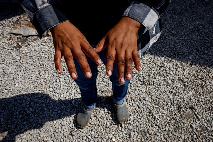 A farm worker, show her hands after working at a plant nursery on November 2, 2023 in Homestead, Florida.