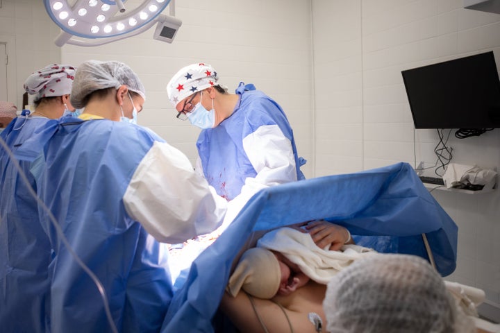 Mother and newborn daughter by cesarean section - Doctors performing a cesarean section in the operating room - Buenos Aires - Argentina