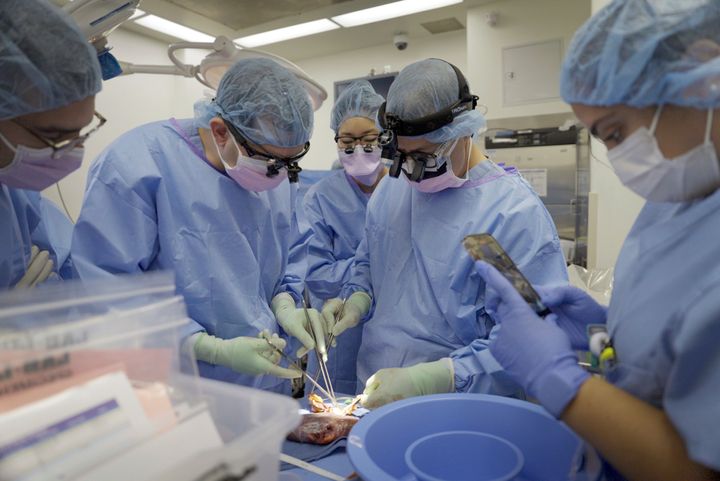 Surgeons remove a gene-edited transplanted pig kidney from the body of Maurice “Mo” Miller at NYU Langone Health in New York on Sept. 13, 2023. For a history-making 61 days and despite a brief rejection blip, a pig’s kidney worked normally inside his brain-dead body.