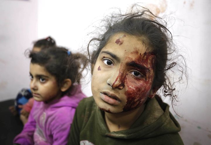(EDITORS NOTE: Image depicts graphic content) Palestinian children injured in an Israeli attack on Abu Amra family house receive medical treatment at al-Aqsa Martyrs Hospital in Deir al Balah, Gaza on March 25, 2024.