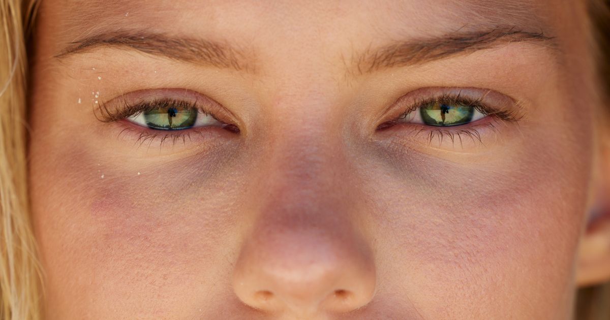 Got Green Eyes? This Doctor Has News For You
