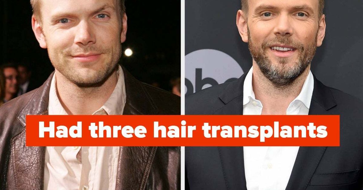 There's A Lot Of Fake Hair In Hollywood, So Here Are 12 Male Celebs Who Have Been Candid About Using Wigs And Surgery To Get Their Locks