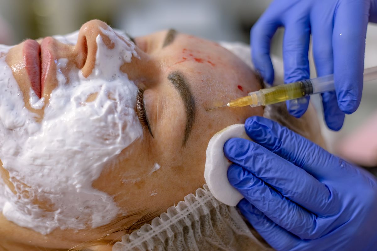Photograph displays face of relaxed middle-aged woman, covered with white mask, undergoing facial beauty treatment. Hands of unidentified beautician in blue gloves carefully performing plasma facelift, injecting rejuvenating substance into woman forehead