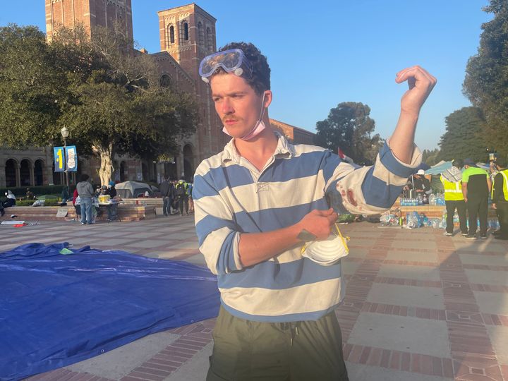 UCLA junior Aidan Doyle, 21, described being attacked by counter-protesters as "the most painful experience" of his life. 