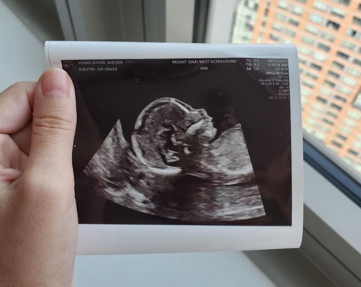 The September 2020 ultrasound photo taken of the author's daughter at 16 weeks.
