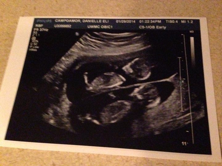 an ultrasound photo of the author's twins