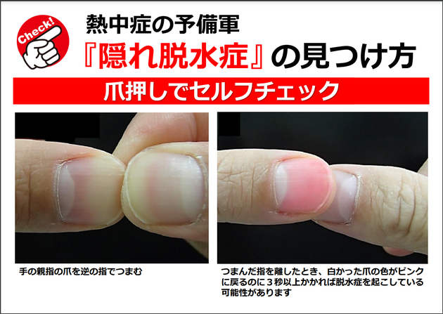 爪を押してセルフチェックする方法