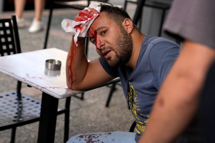 Ένας διαδηλωτής αιμορραγεί μετά από συγκρούσεις με την αστυνομία έξω από δικαστήριο στην Καλαμάτα, στη νοτιοδυτική Ελλάδα, την Τρίτη 21 Μαΐου 2024. Εννέα Αιγύπτιοι δικάζονται, κατηγορούμενοι για ναυάγιο που σκότωσε εκατοντάδες μετανάστες και προκάλεσε σοκ μέσω των επιχειρήσεων προστασίας των συνόρων και ασύλου της Ευρωπαϊκής Ένωσης. (AP Photo/Thanassis Stavrakis)