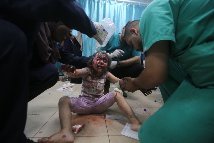 Τραυματισμένο παιδί από ισραηλινούς βομβαρδισμούς στο νοσοκομέιο Αλ Ακσα στην Γάζα (8 Ιουνίου 2024) 