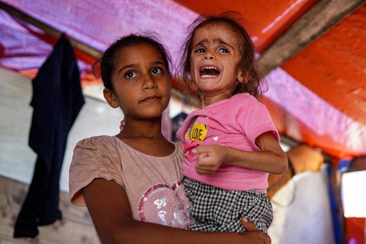 Hana Abdelrahaman al-Rai, a 4-year-old child suffering from malnutrition, is pictured in a tent in Zawayda in central Gaza on June 4, 2024. She was displaced from Gaza City's eastern suburb of Shujaiya. 