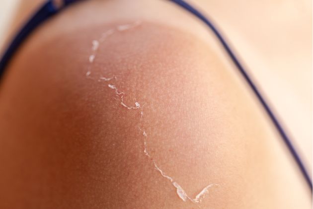 Today’s anti-sunscreen advocates promote conspiracy theories that sunscreen causes cancer and was created as a ploy by pharmaceutical companies to boost profits and sicken people.