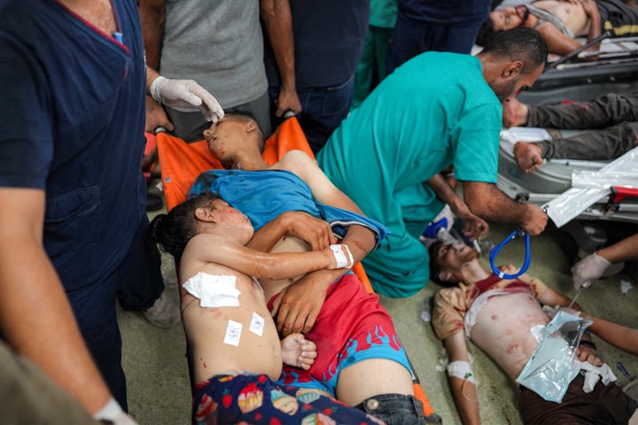 (EDITORS NOTE: Graphic content) Two young boys who were killed lie in a stretcher at a trauma ward in Nasser Medical Complex in Khan Younis in the southern Gaza Strip on July 16, 2024.