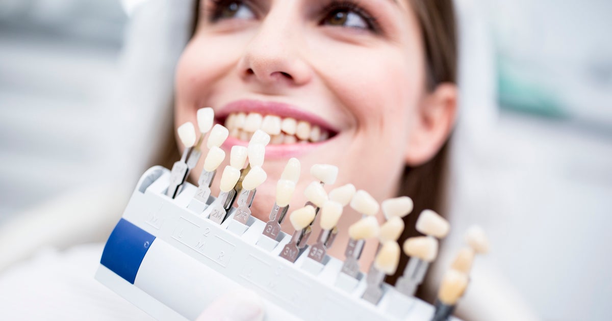 This Viral Dental Trend Is Not Only Dangerous, But Illegal Too This Viral Dental Trend Is Not Only Dangerous, But Illegal Too