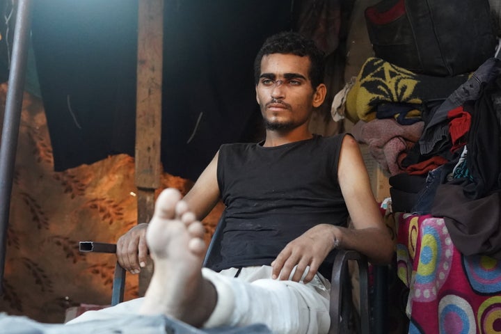 Palestinian Fathi Abdulal, 21, rests in a tent after being released from an Israeli prison after seven months of detention in Deir al-Balah, Gaza, on July 27, 2024. Abdulal, who studied electrical engineering, suffers from severe mental health problems and open wounds after being tortured in prison.